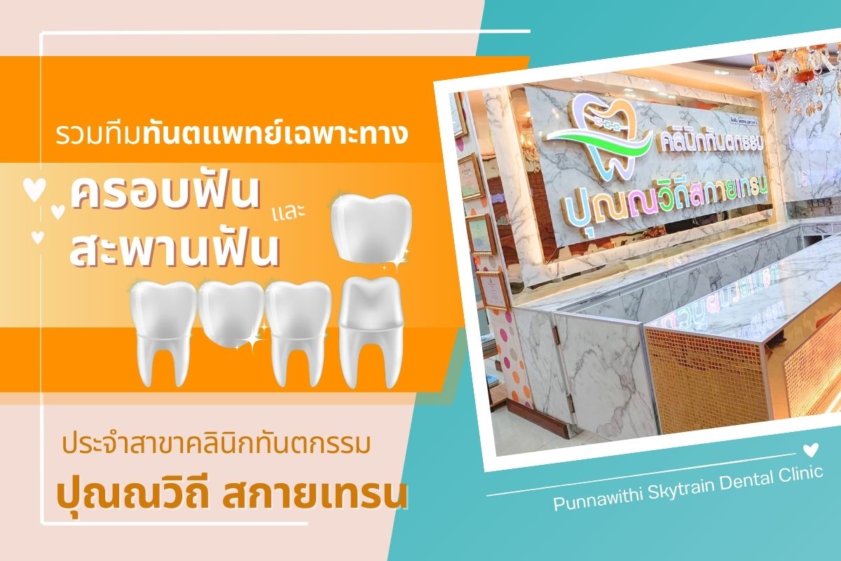 ปุณณวิถี สกายเทรน- ครอบฟันสะพานฟัน