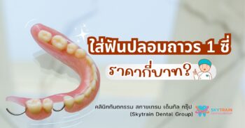 permanent dentures